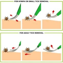 TickCheck Premium Dog Tick Removal Kit -Pet Wellness 325731 PT2. AC SS1800 V1651772481